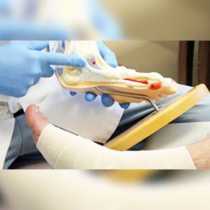 Rivascolarizzazione nel piede diabetico - Chirurgo Vascolare Roma